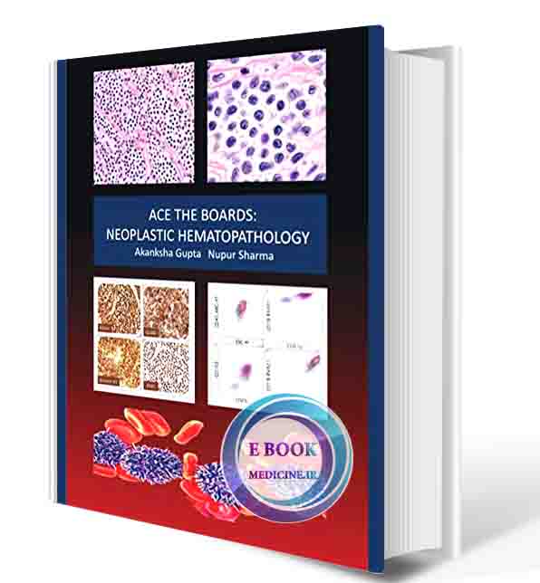 دانلود کتاب Ace the Boards: Neoplastic Hematopathology (Ace My Path) 2020 (ORIGINAL PDF)